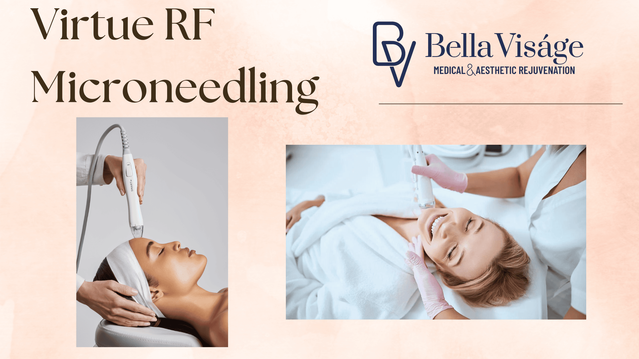 Bella Blog Banners (1)