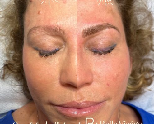 bella-microblading-client1-2