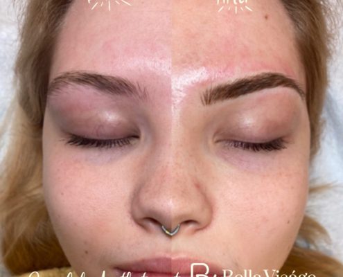 bella-microblading-client2-2