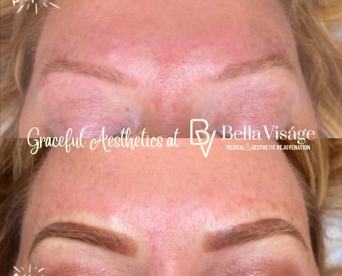 bella-microblading-client4-1