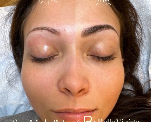 bella-microblading-client6-2