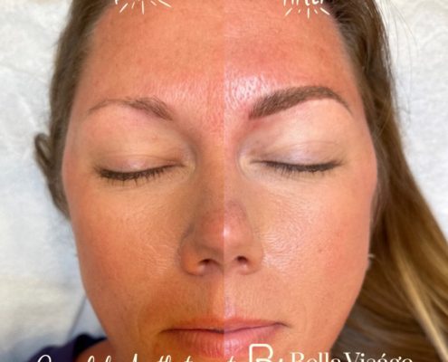 bella-microblading-client7-2