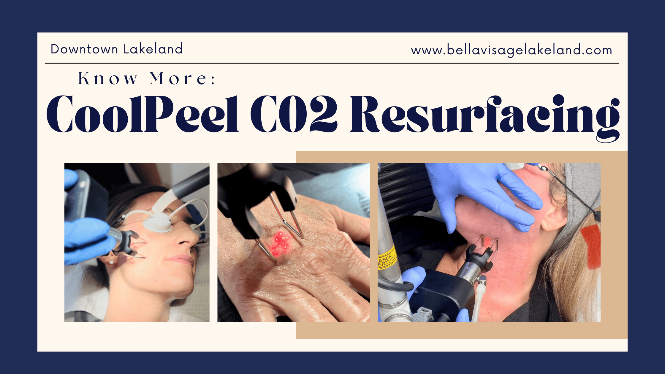 CoolPeel Blog Header CoolPeel CO2 Resurfacing