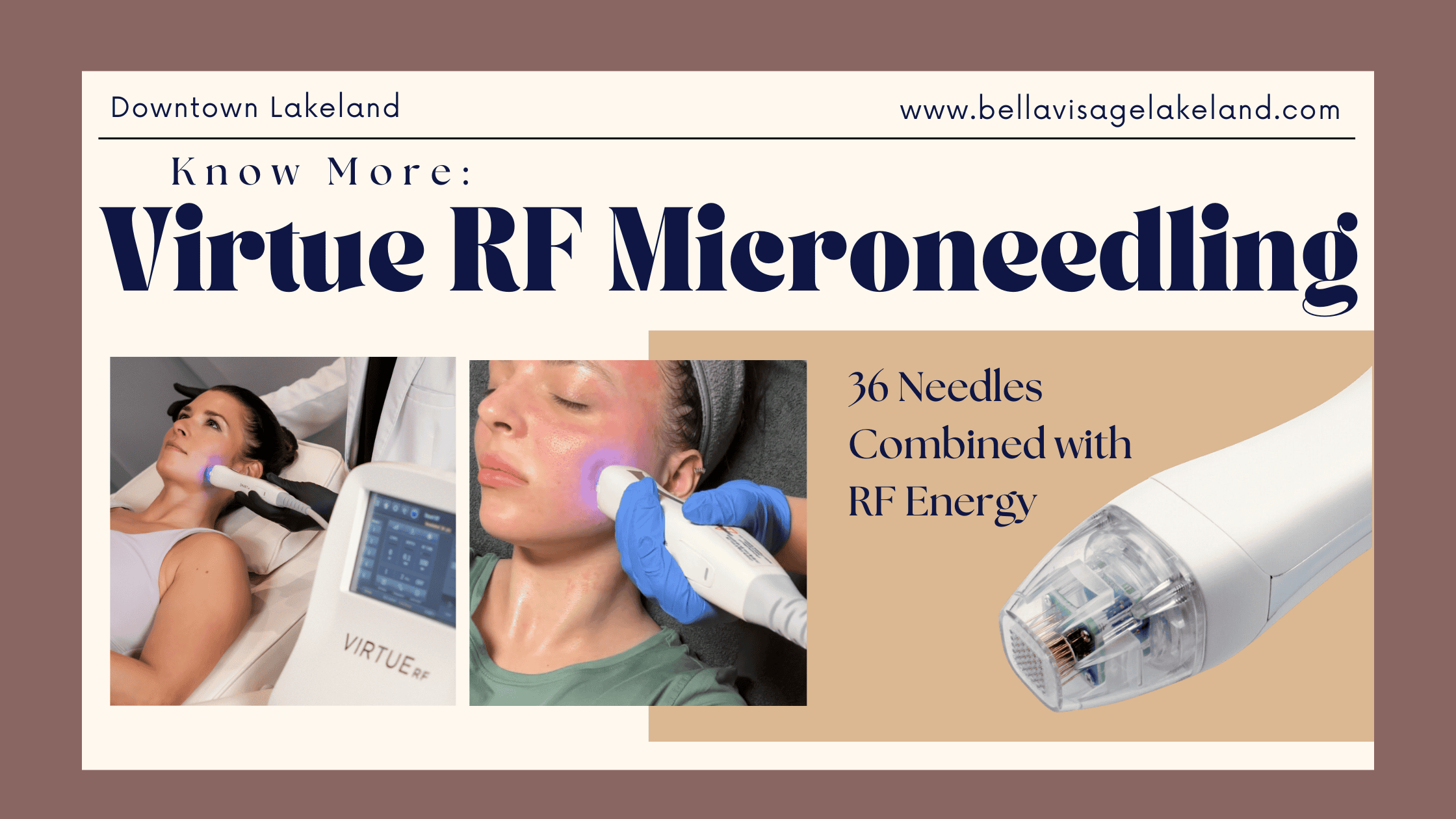 Virtue RF Microneedling in Lakeland