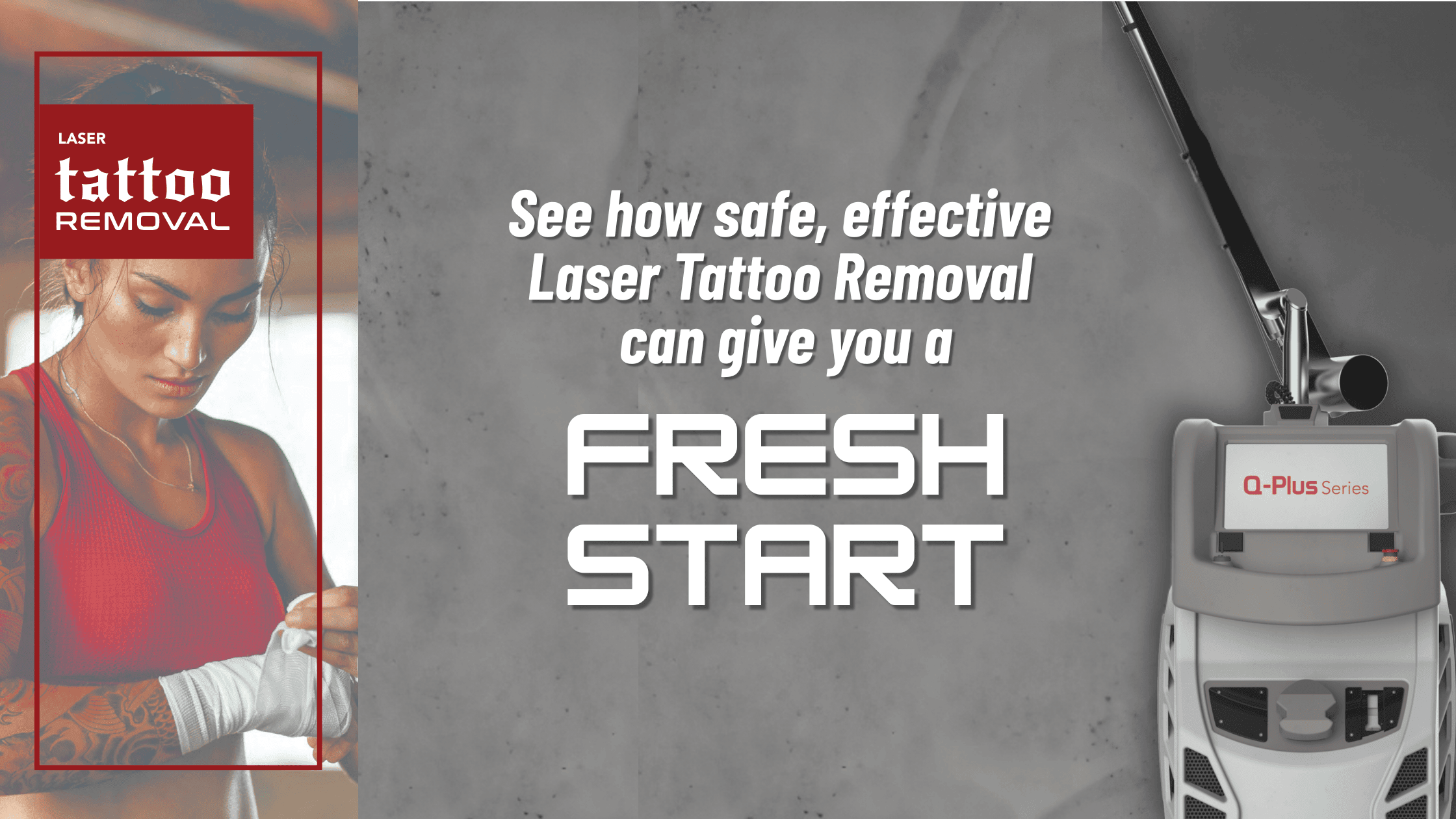 Laser Tattoo removal in Lakeland