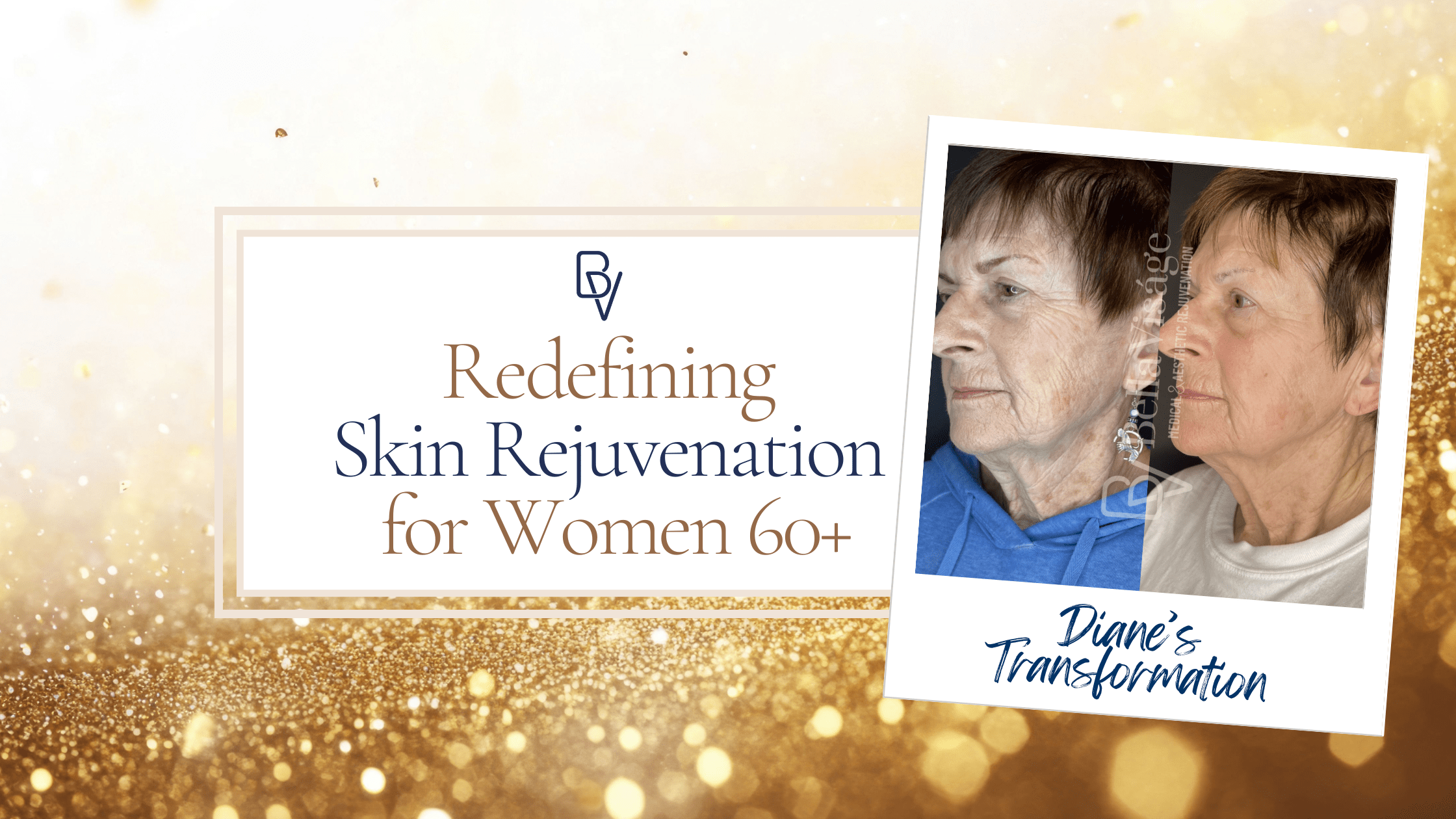 Laser Tattoo removal in Lakeland